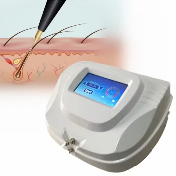 Triệt lông lâu dài bằng điện phân hoặc laser