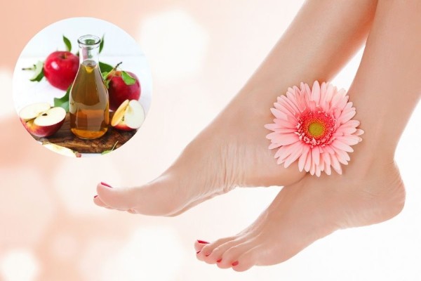 Axit có trong giấm táo có khả năng làm mềm lớp da mắt cá chân bị chai