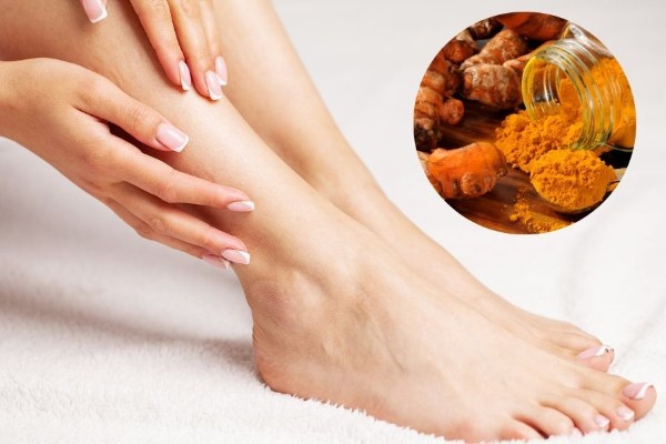 Nghệ kết hợp mật ong – dưỡng da và kháng khuẩn