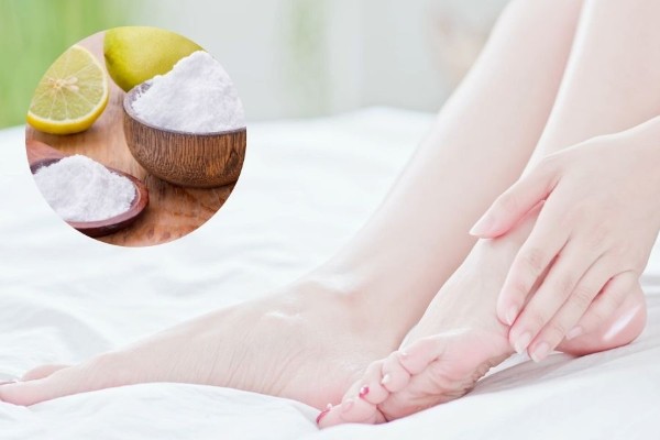 Chanh và baking soda giúp loại bỏ các vết chai trên chân dễ dàng hơn