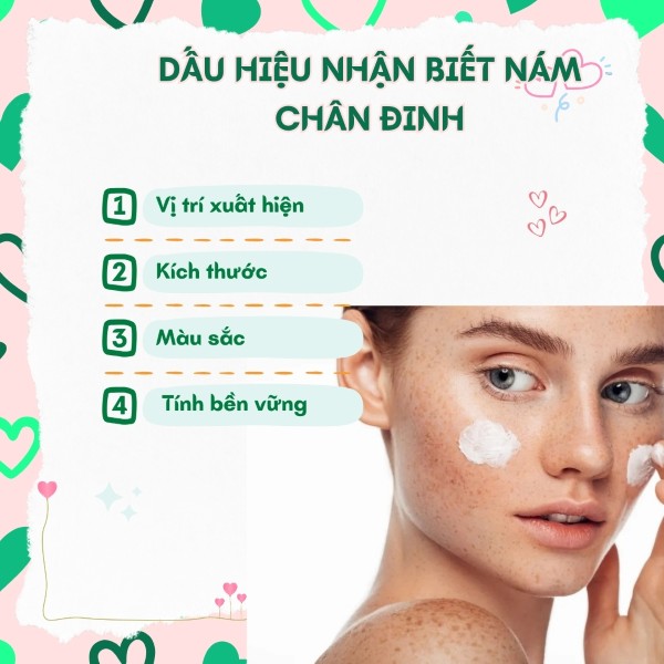 Dấu hiệu nhận biết nám chân đinh