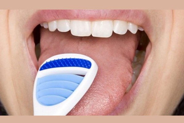 Phòng ngừa nốt ruồi ở lưỡi và bảo vệ sức khỏe răng miệng