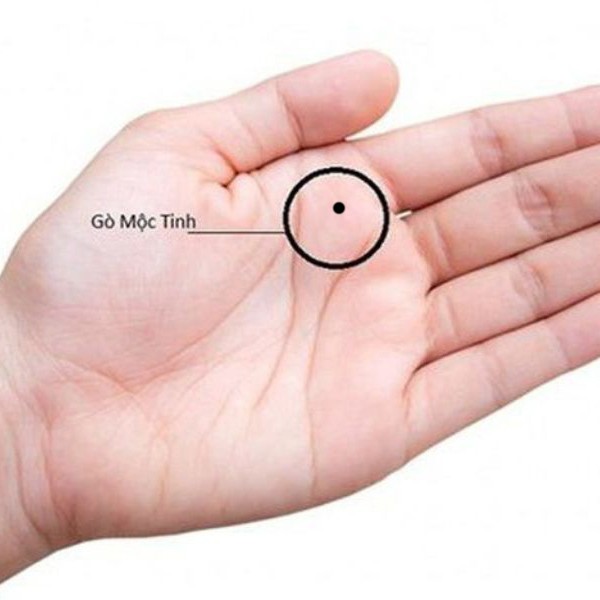 Nốt ruồi trong lòng bàn tay trái ở nam