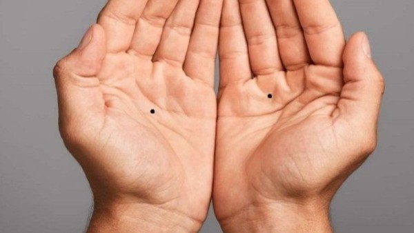 Ý nghĩa vị trí nốt ruồi trên tay