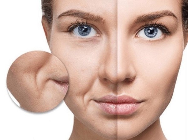 Rãnh cười là gì?