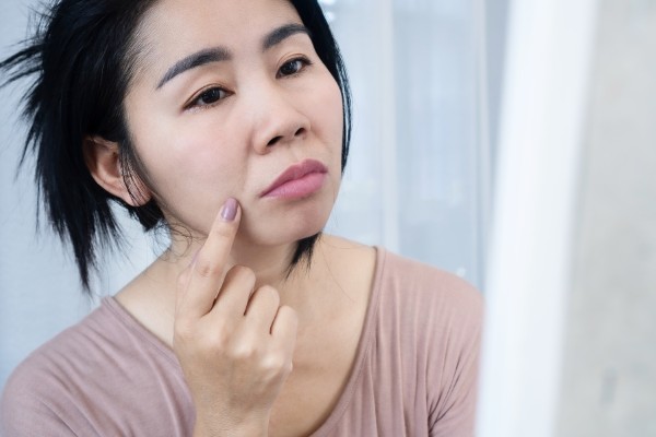 Nguyên nhân khiến rãnh cười ngày càng hằn sâu