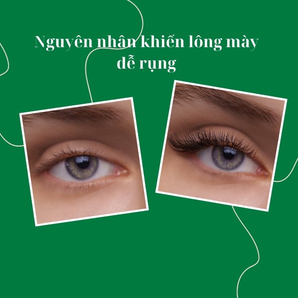 Nguyên nhân khiến lông mày dễ rụng