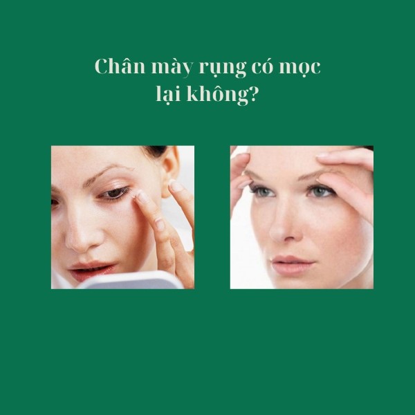 Chân mày rụng có mọc lại không?