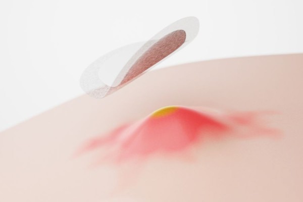 Tác hại của miếng dán mụn là gì?