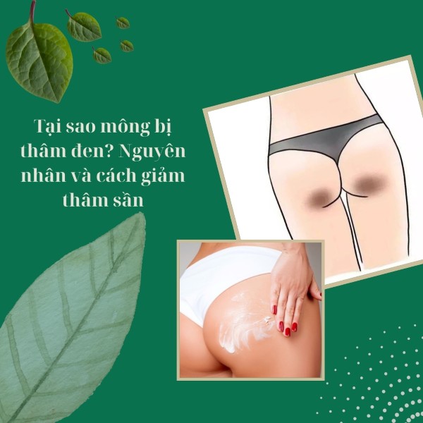 Tại sao mông bị thâm đen? Nguyên nhân và cách giảm thâm sần