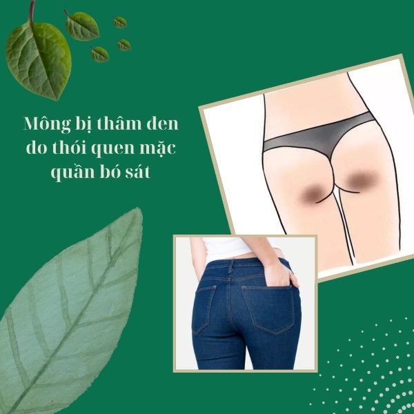 Mông bị thâm đen do thói quen mặc quần bó sát