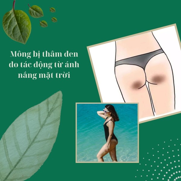 Mông bị thâm đen do tác động từ ánh nắng mặt trời