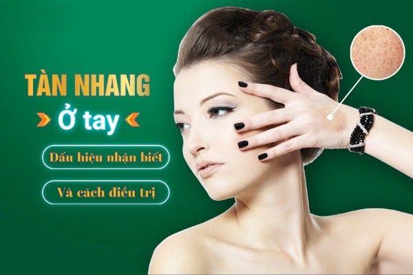 10 Cách trị tàn nhang ở tay tại nhà, đơn giản và tiết kiệm 10 Cách trị tàn nhang ở tay tại nhà, đơn giản và tiết kiệm
