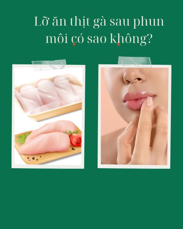 Lỡ ăn thịt gà sau phun môi có sao không?