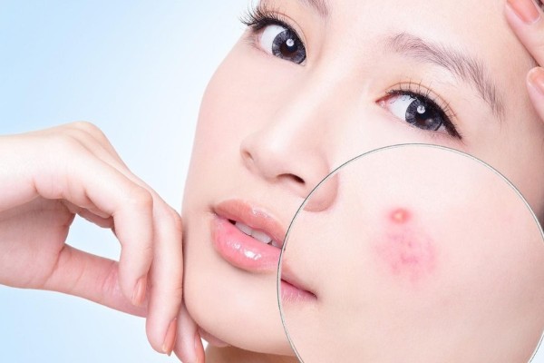 Chăm sóc da đúng cách