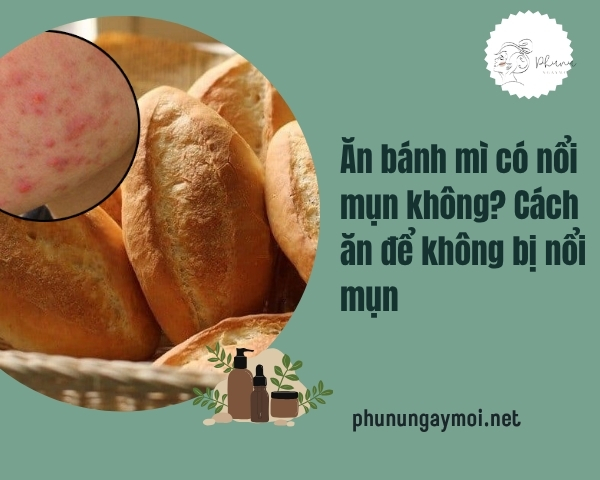 Ăn bánh mì có nổi mụn không