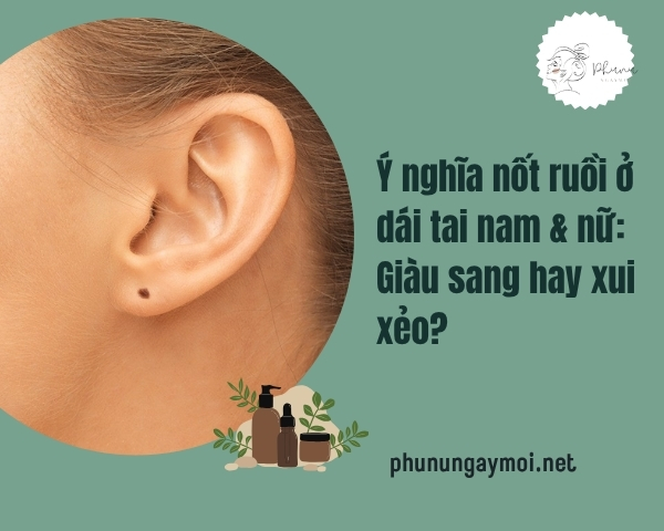 nốt ruồi ở dái tai