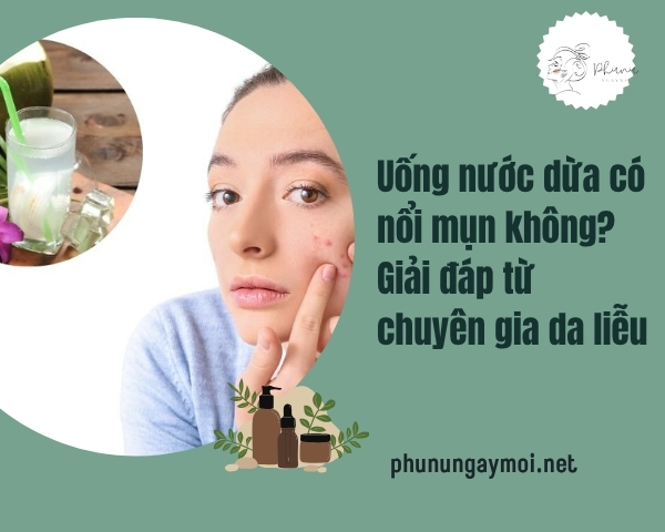 Uống nước dừa có nổi mụn không