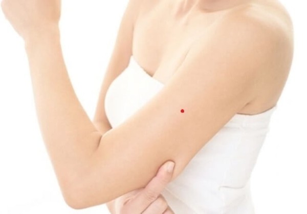 Có nên tẩy nốt ruồi ở cánh tay? Lời khuyên từ chuyên gia