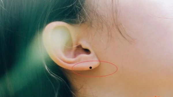 Ý nghĩa nốt ruồi ở dái tai theo nhân tướng học