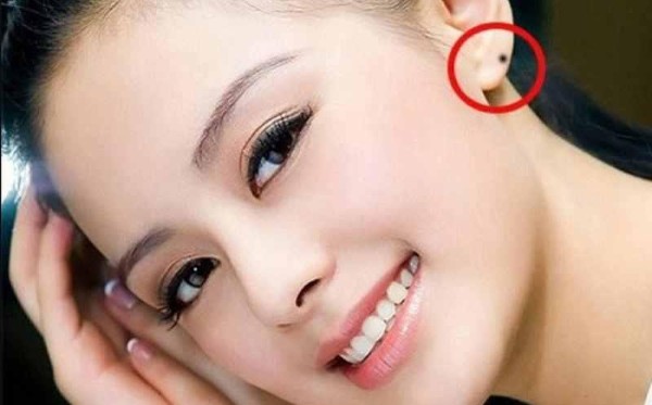 Nốt ruồi ở dái tai nữ giới