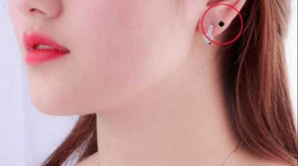 Ý nghĩa nốt ruồi son ở dái tai