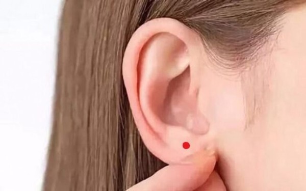 Có nên tẩy nốt ruồi ở dái tai không?