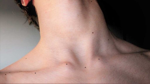 Nốt ruồi ở chính giữa xương quai xanh