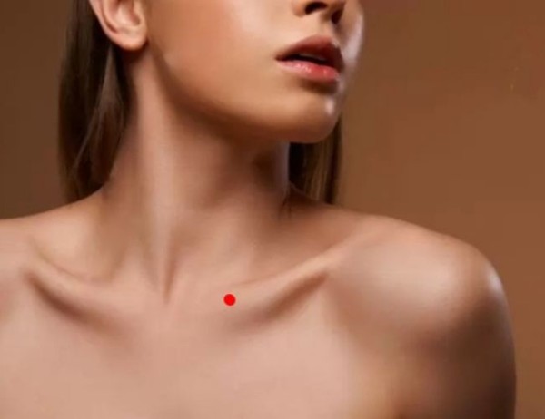 Nốt ruồi son ở xương quai xanh