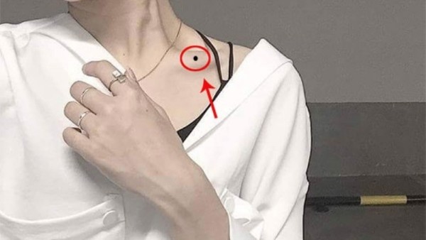 Nốt ruồi ở xương quai xanh là tốt hay xấu?