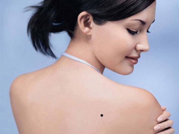 Nốt ruồi ở lưng bên phải phụ nữ
