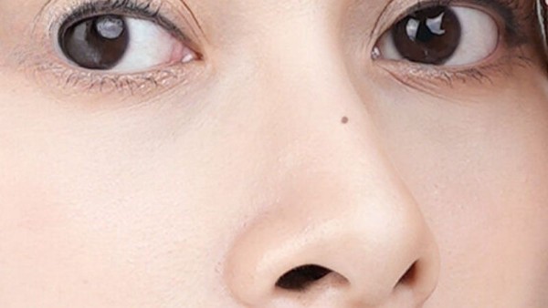 Ý nghĩa chung của nốt ruồi sống mũi theo nhân tướng học 