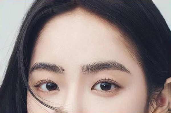 Có nên tẩy nốt ruồi trong lông mày không