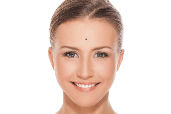 Nốt ruồi Vượng Phu ích tử có thực sự may mắn?