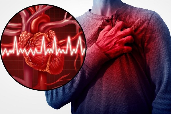 Nguy cơ mắc bệnh tim mạch