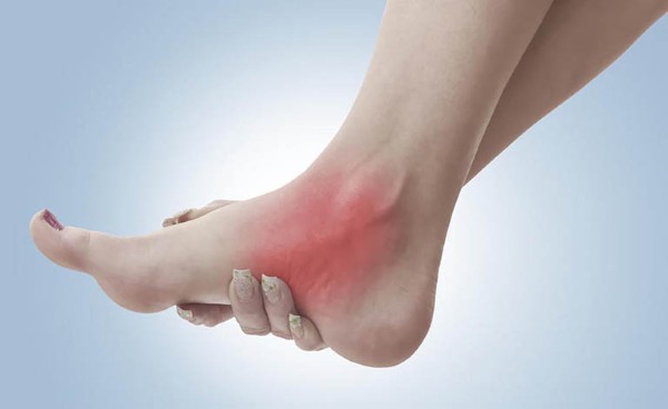Người mắc bệnh gout