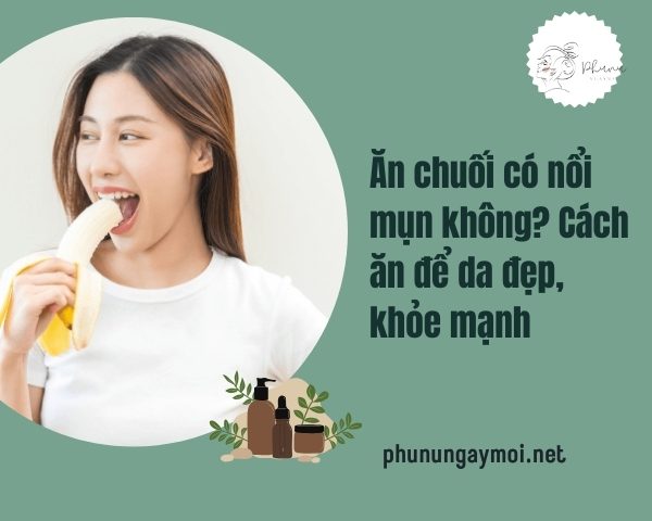 Ăn chuối có nổi mụn không?
