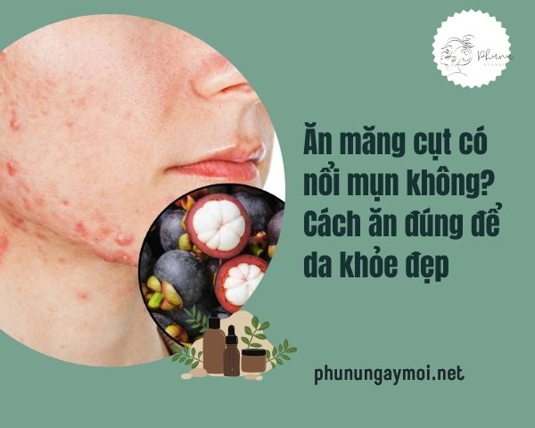 Ăn măng cụt có nổi mụn không