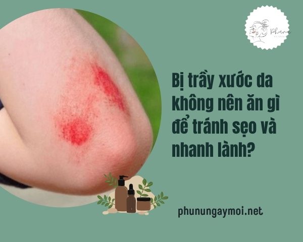 Bị trầy xước da không nên ăn gì