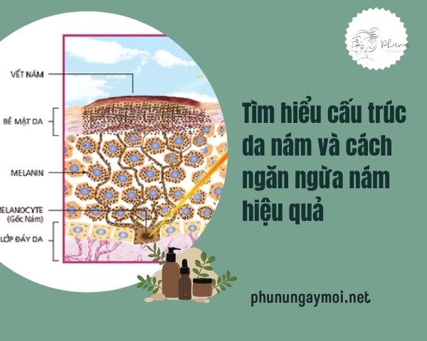 cấu trúc da nám