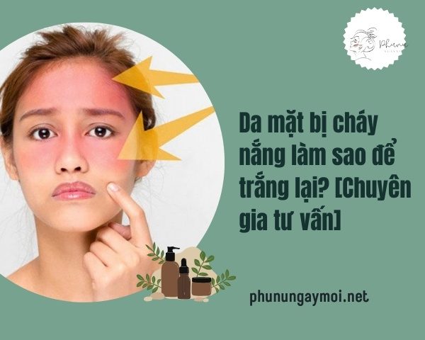 Da mặt bị cháy nắng làm sao để trắng lại