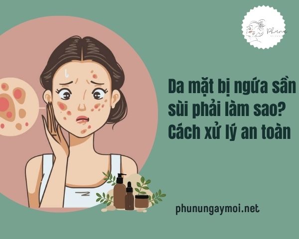 Da mặt bị ngứa sần sùi phải làm sao