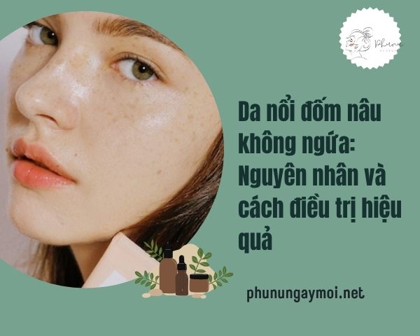 Da nổi đốm nâu không ngứa
