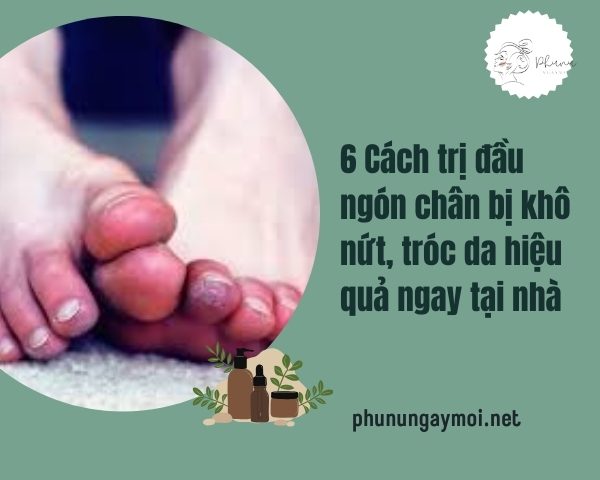 đầu ngón chân bị khô nứt