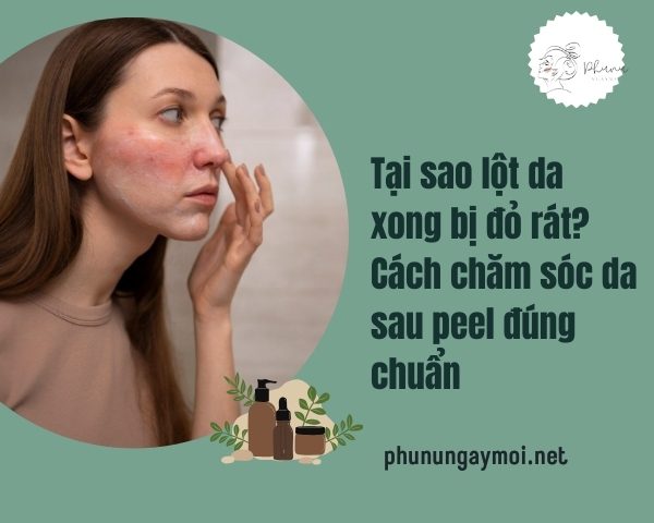 lột da xong bị đỏ rát