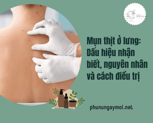 Mụn thịt ở lưng