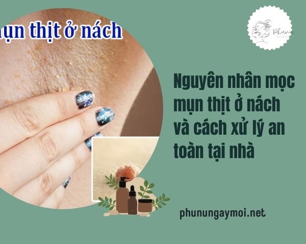 mọc mụn thịt ở nách