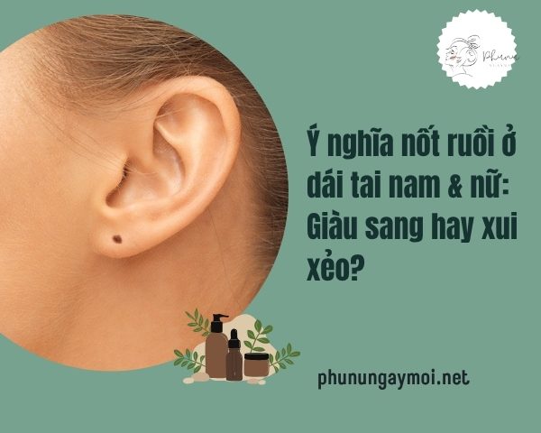 nốt ruồi ở dái tai