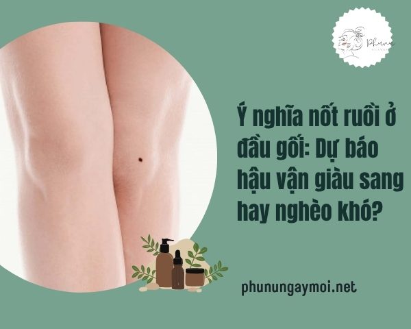nốt ruồi ở đầu gối