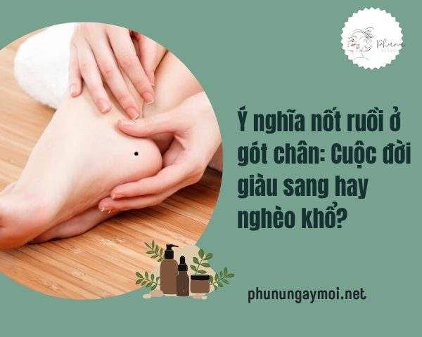 nốt ruồi ở gót chân